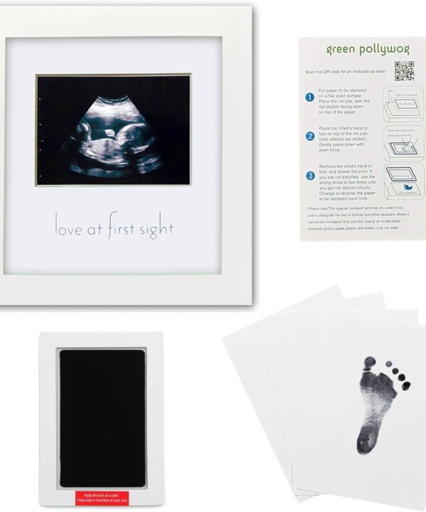 Green Pollywog | Sonogram Picture and Hand/Footprint Kit | Elegant White Picture Frame | Non-Toxic | Inkless Footprint | Baby Footprint Frame | Newborn Footprint Kit | Baby Ink Pad